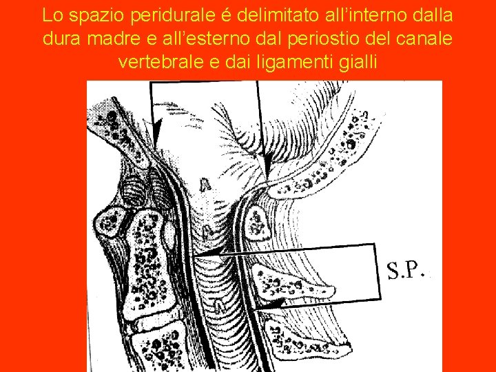 Lo spazio peridurale é delimitato all’interno dalla dura madre e all’esterno dal periostio del