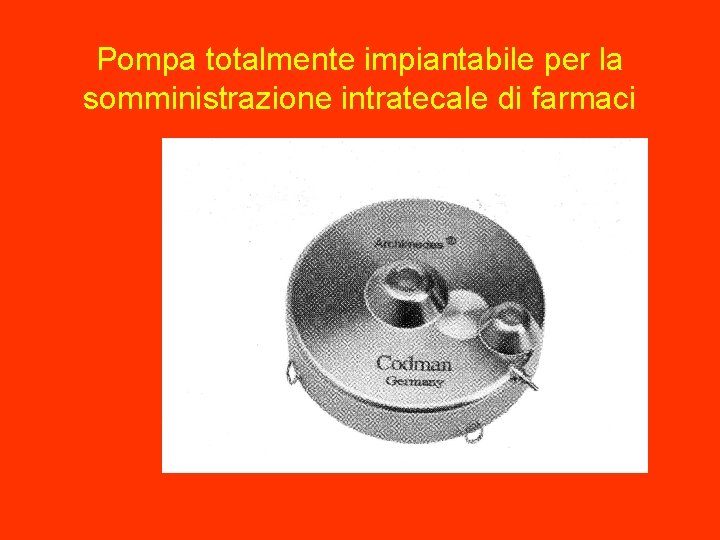 Pompa totalmente impiantabile per la somministrazione intratecale di farmaci 