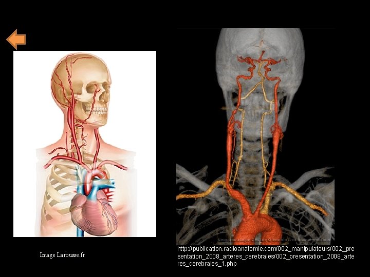 Image Larousse. fr http: //publication. radioanatomie. com/002_manipulateurs/002_pre sentation_2008_arteres_cerebrales/002_presentation_2008_arte res_cerebrales_1. php 