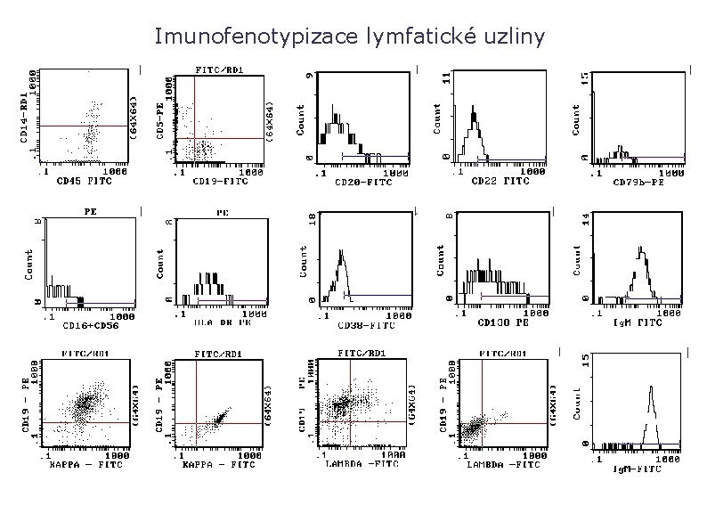 Imunofenotypizace lymfatické uzliny 