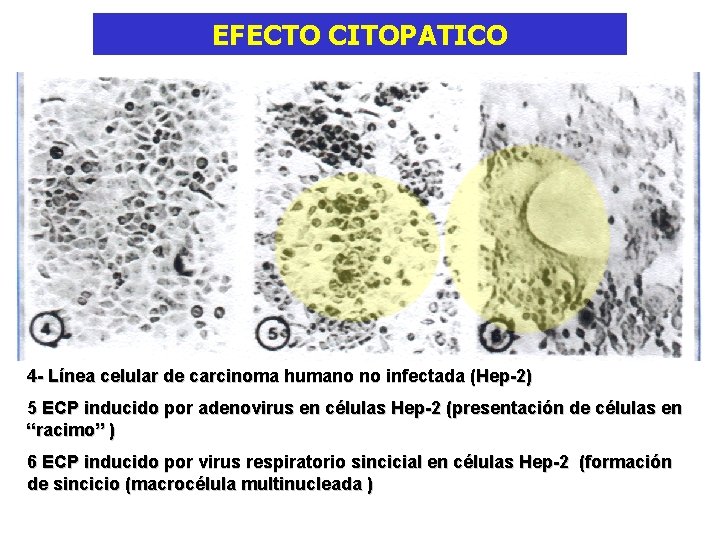 EFECTO CITOPATICO 4 - Línea celular de carcinoma humano no infectada (Hep-2) 5 ECP