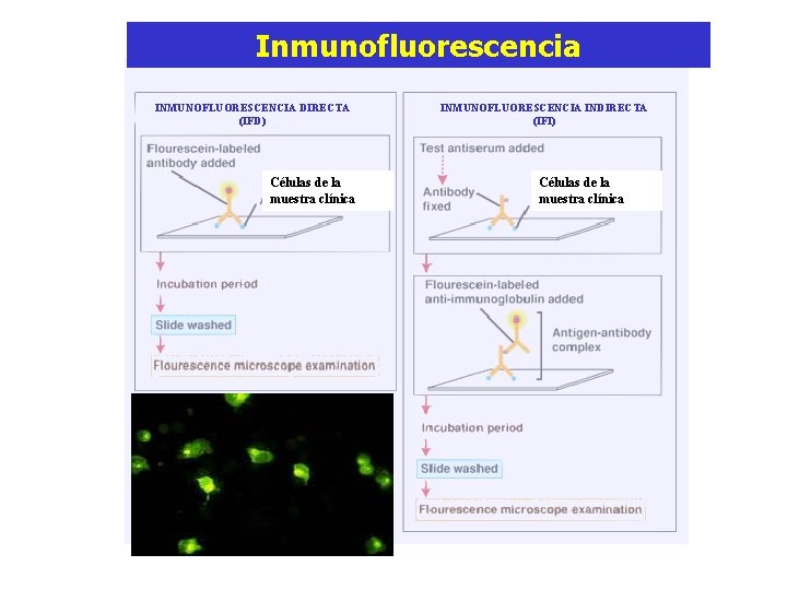 Inmunofluorescencia INMUNOFLUORESCENCIA DIRECTA (IFD) Células de la muestra clínica INMUNOFLUORESCENCIA INDIRECTA (IFI) Células de