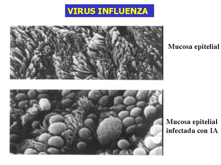 VIRUS INFLUENZA Mucosa epitelial infectada con IA 