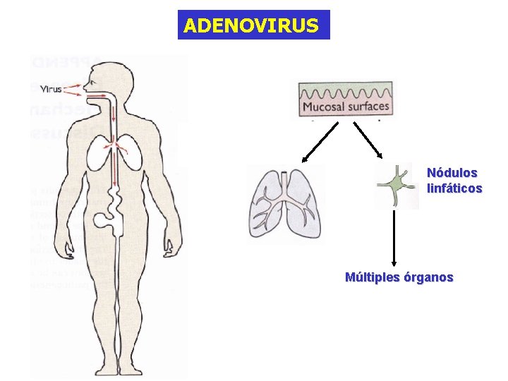 ADENOVIRUS Nódulos linfáticos Múltiples órganos 