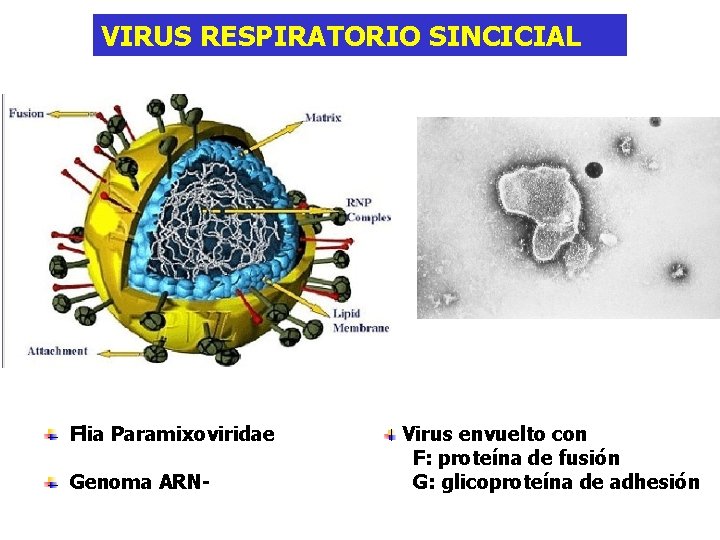 VIRUS RESPIRATORIO SINCICIAL Flia Paramixoviridae Genoma ARN- Virus envuelto con F: proteína de fusión