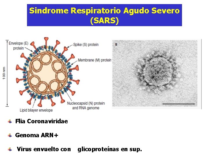 Sindrome Respiratorio Agudo Severo (SARS) Flia Coronaviridae Genoma ARN+ Virus envuelto con glicoproteínas en