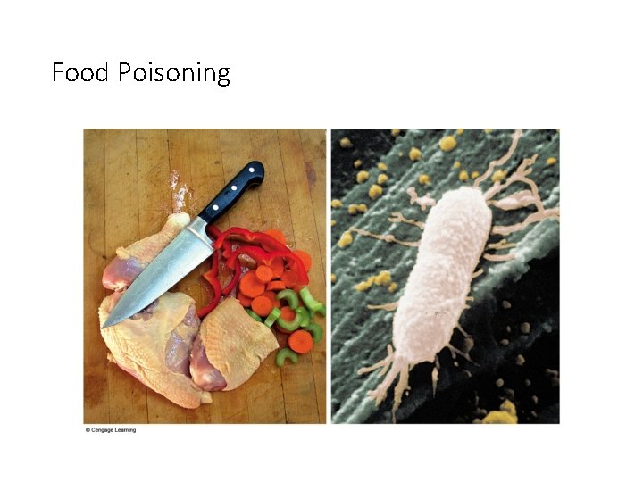 Food Poisoning 