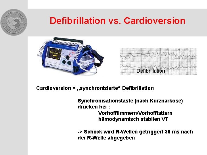 Defibrillation vs. Cardioversion Defibrillation Cardioversion = „synchronisierte“ Defibrillation Synchronisationstaste (nach Kurznarkose) drücken bei :