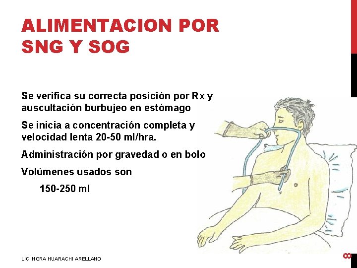 ALIMENTACION POR SNG Y SOG Se verifica su correcta posición por Rx y auscultación