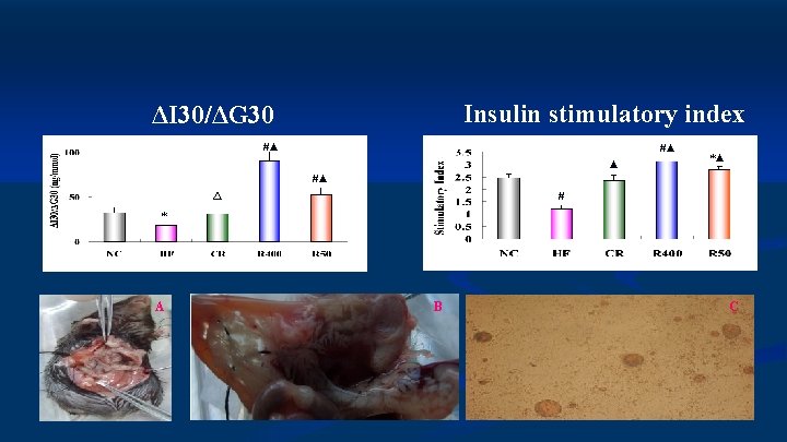 Insulin stimulatory index ΔI 30/ΔG 30 #▲ #▲ ▲ *▲ #▲ # △ *