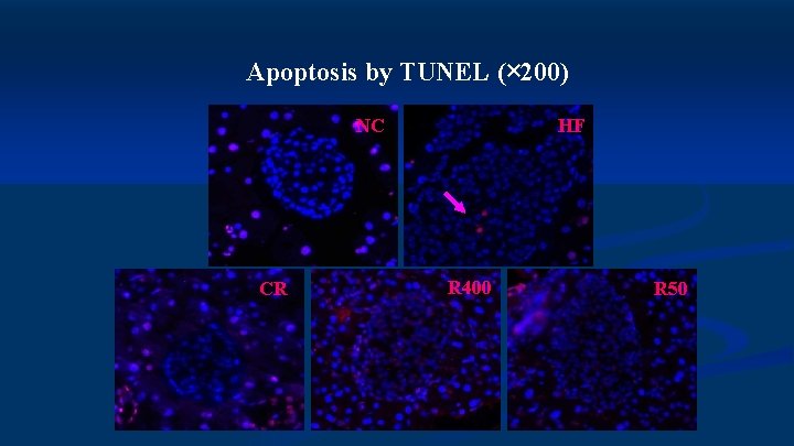 Apoptosis by TUNEL (× 200) NC CR HF R 400 R 50 