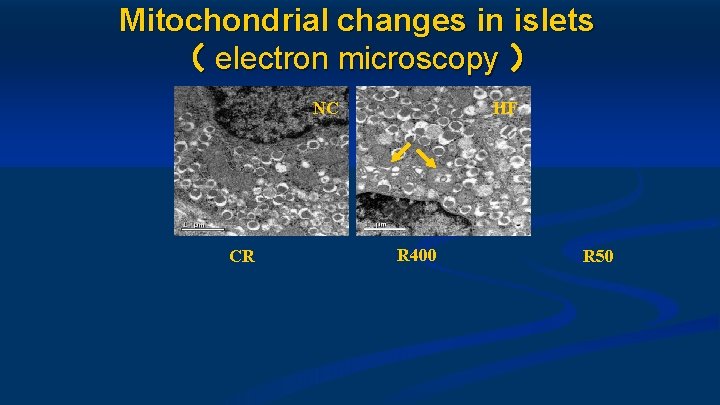 Mitochondrial changes in islets （ electron microscopy ） NC CR HF R 400 R