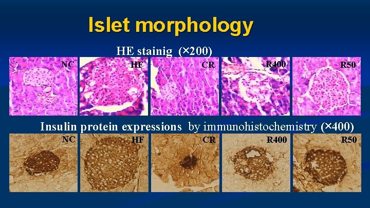 Islet morphology HE stainig (× 200) NC HF CR R 400 R 50 Insulin