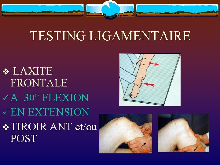TESTING LIGAMENTAIRE v LAXITE FRONTALE ü A 30° FLEXION ü EN EXTENSION v TIROIR