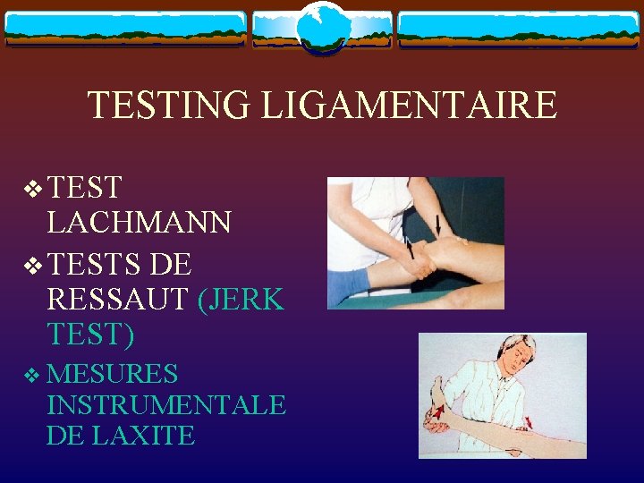 TESTING LIGAMENTAIRE v TEST LACHMANN v TESTS DE RESSAUT (JERK TEST) v MESURES INSTRUMENTALE