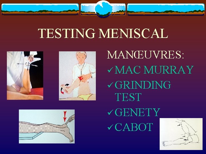 TESTING MENISCAL MANŒUVRES: ü MAC MURRAY ü GRINDING TEST ü GENETY ü CABOT 