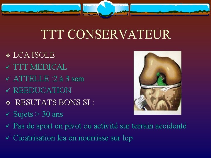 TTT CONSERVATEUR LCA ISOLE: ü TTT MEDICAL ü ATTELLE : 2 à 3 sem