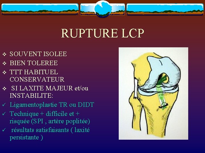 RUPTURE LCP v v ü ü ü SOUVENT ISOLEE BIEN TOLEREE TTT HABITUEL CONSERVATEUR