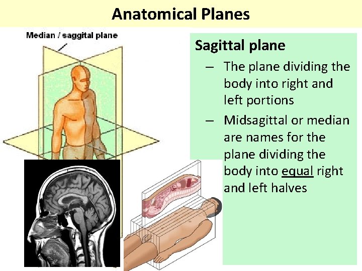 Anatomical Planes Sagittal plane – The plane dividing the body into right and left