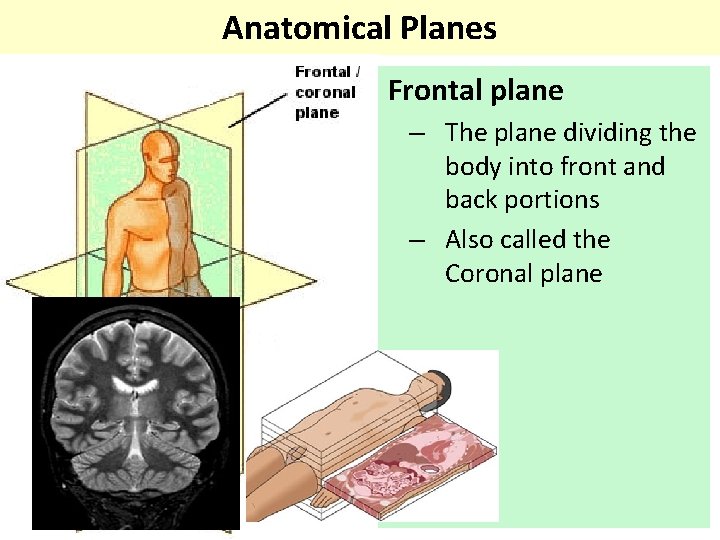 Anatomical Planes Frontal plane – The plane dividing the body into front and back