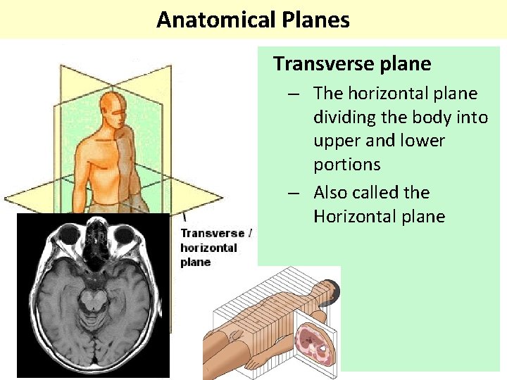 Anatomical Planes Transverse plane – The horizontal plane dividing the body into upper and