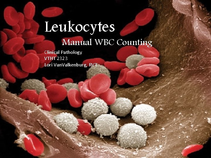 Leukocytes Manual WBC Counting Clinical Pathology VTHT 2323 Lori Van. Valkenburg, RVT 