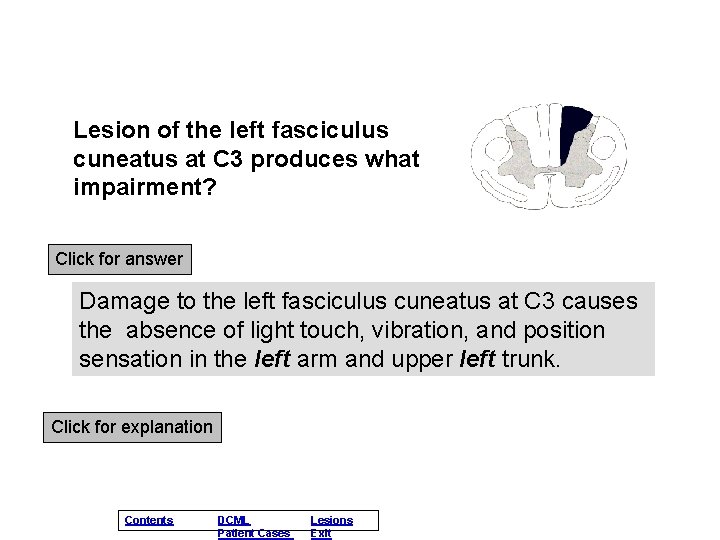 Lesion of the left fasciculus cuneatus at C 3 produces what impairment? Click for Lesion of the left fasciculus cuneatus at C 3 produces what impairment? Click for