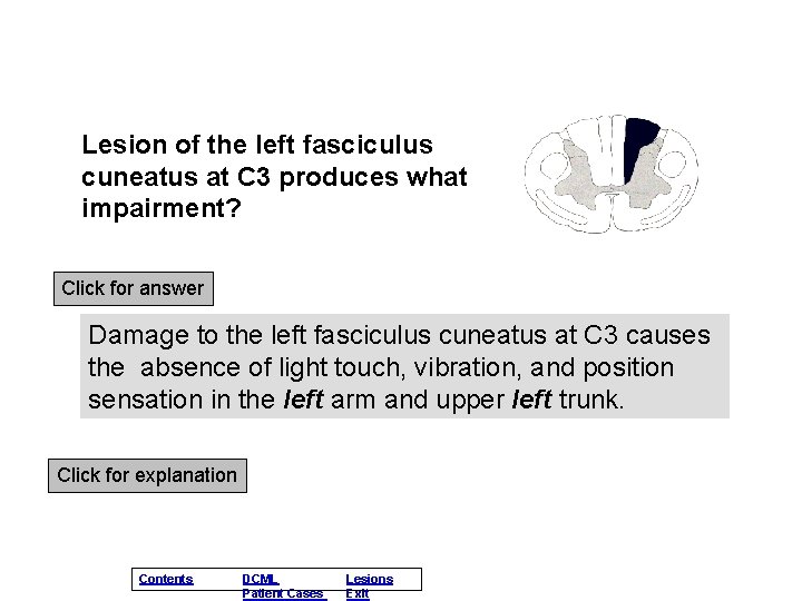 Lesion of the left fasciculus cuneatus at C 3 produces what impairment? Click for