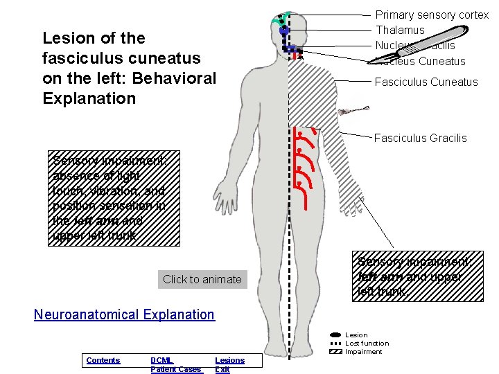 Lesion of the fasciculus cuneatus on the left: Behavioral Explanation Primary sensory cortex Thalamus
