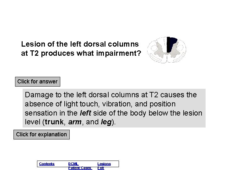 Lesion of the left dorsal columns at T 2 produces what impairment? Click for