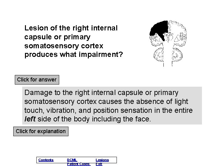 Lesion of the right internal capsule or primary somatosensory cortex produces what impairment? Click