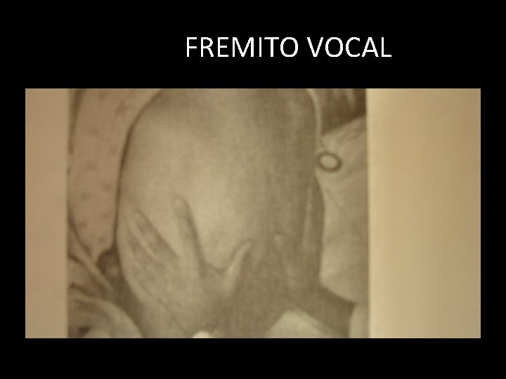 FREMITO VOCAL FREMITO VOCAL