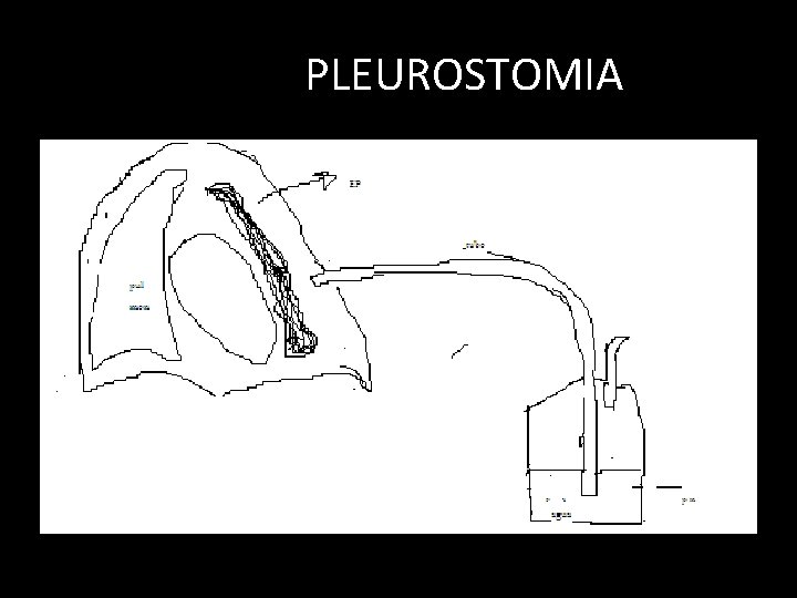 PLEUROSTOMIA PLEUROSTOMIA