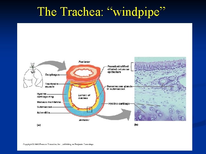 The Trachea: “windpipe” 