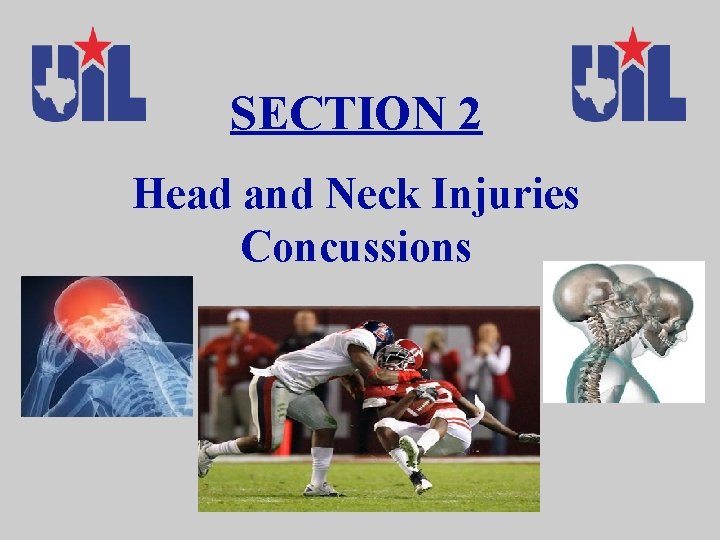 SECTION 2 Head and Neck Injuries Concussions 
