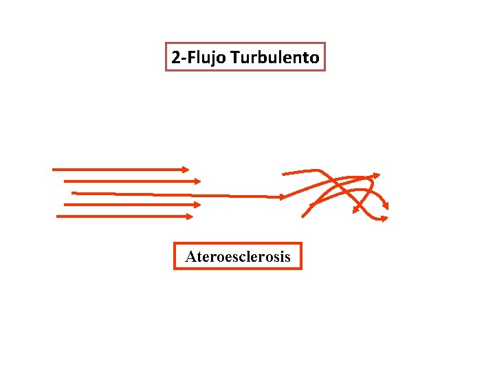 Fisiología Vascular 2 -Flujo Turbulento Ateroesclerosis Fisiología Vascular 2 -Flujo Turbulento Ateroesclerosis