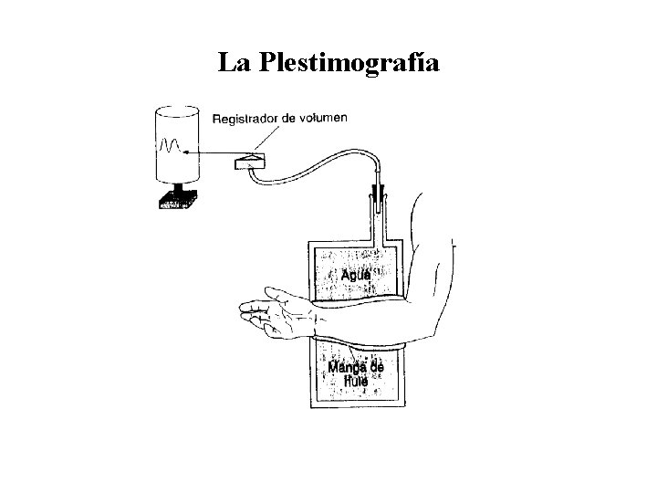 La Plestimografía La Plestimografía
