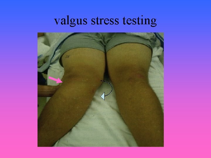 valgus stress testing 