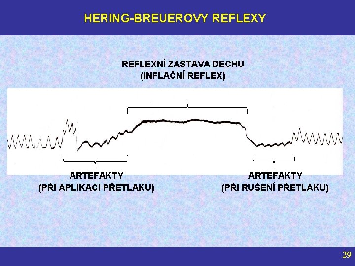 HERING-BREUEROVY REFLEXNÍ ZÁSTAVA DECHU (INFLAČNÍ REFLEX) ARTEFAKTY (PŘI APLIKACI PŘETLAKU) ARTEFAKTY (PŘI RUŠENÍ PŘETLAKU)