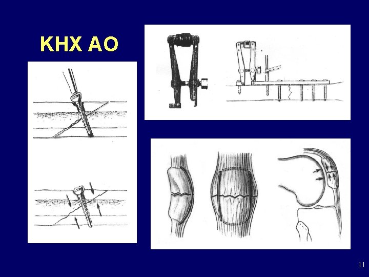 KHX AO 11 