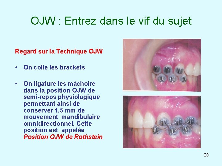 OJW : Entrez dans le vif du sujet Regard sur la Technique OJW • OJW : Entrez dans le vif du sujet Regard sur la Technique OJW •