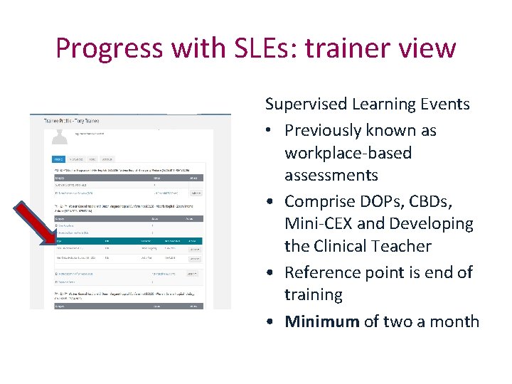 Progress with SLEs: trainer view Supervised Learning Events • Previously known as workplace-based assessments