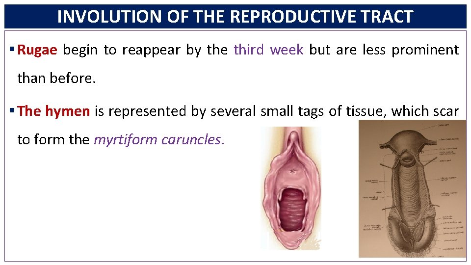 INVOLUTION OF THE REPRODUCTIVE TRACT § Rugae begin to reappear by the third week
