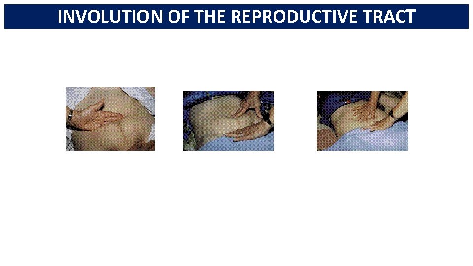 INVOLUTION OF THE REPRODUCTIVE TRACT 