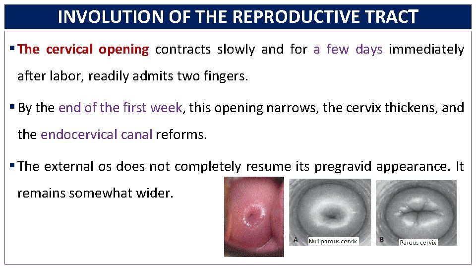 INVOLUTION OF THE REPRODUCTIVE TRACT § The cervical opening contracts slowly and for a