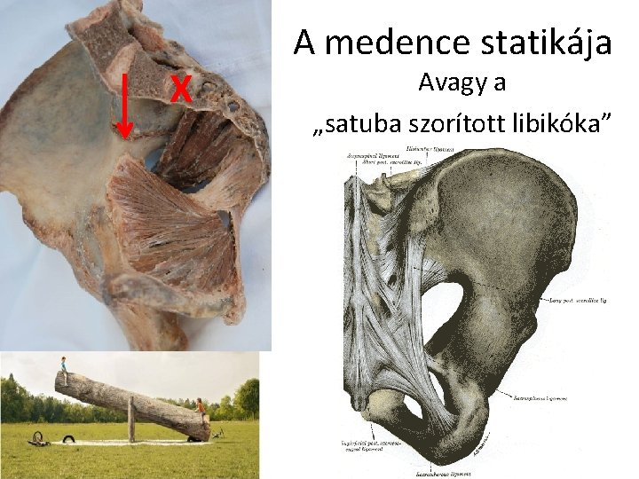 X A medence statikája Avagy a „satuba szorított libikóka” 