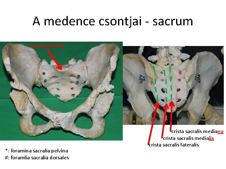 A medence csontjai - sacrum promontorium * * *: foramina sacralia pelvina #: foramlia