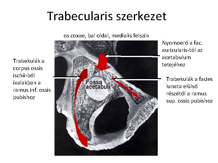 Trabecularis szerkezet os coxae, bal oldal, medialis felszín Trabekulák a corpus ossis ischii-ből ívalakban