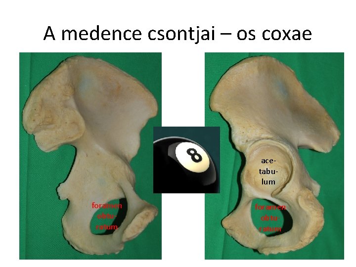 A medence csontjai – os coxae acetabulum foramen obturatum 