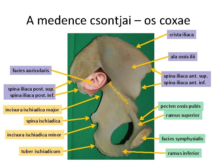 A medence csontjai – os coxae crista iliaca ala ossis ilii facies auricularis lin